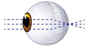 normal vision on retina